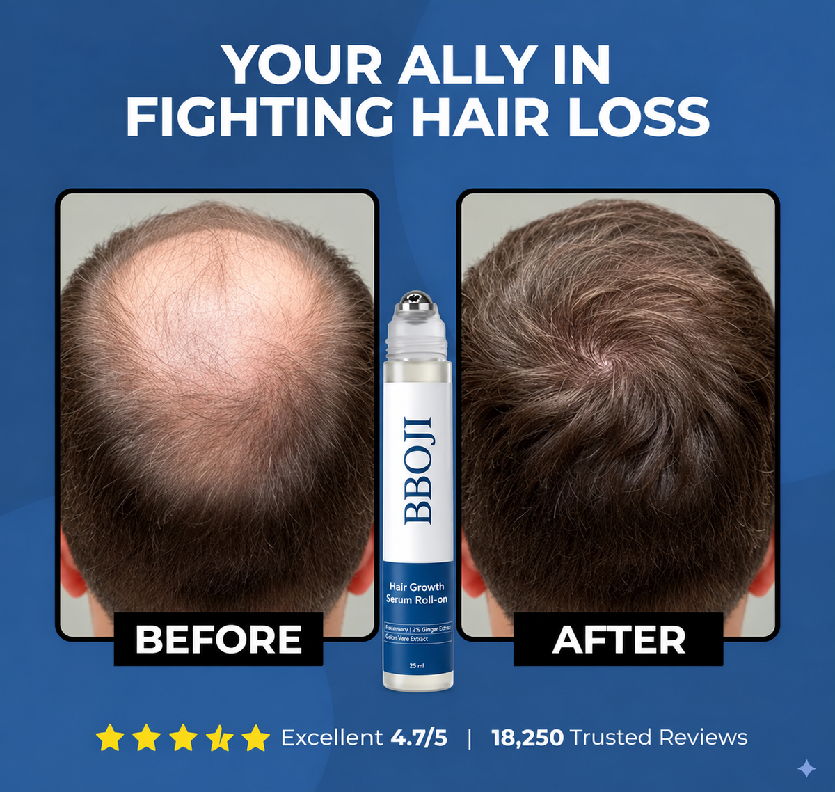 BBOJI Hair Growth Serum Roll on