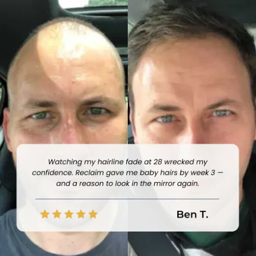 BBOJI Hair Growth Serum Roll on
