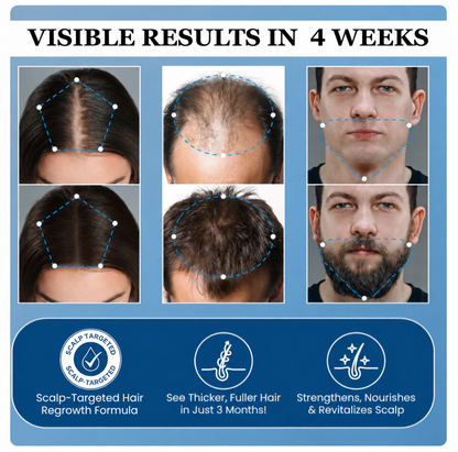 BBOJI Hair Growth Serum Roll on